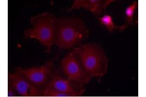 Image no. 2 for anti-Receptor tyrosine-protein kinase erbB-2 (ErbB2/Her2) (pTyr877) antibody (ABIN196748) (ErbB2/Her2 antibody  (pTyr877))