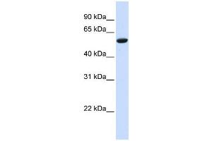 Human HeLa; WB Suggested Anti-ZNF77 Antibody Titration: 0.
