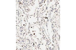 Immunohistochemical analysis of paraffin-embedded human lung tissue using B performed on the Leica® BOND RXm. (Slc6a14 antibody  (C-Term))