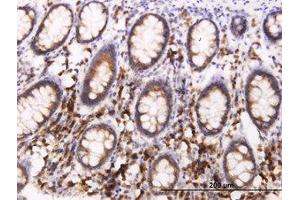 Image no. 3 for anti-B-Cell Receptor-Associated Protein 29 (BCAP29) (AA 125-241) antibody (ABIN599278) (BCAP29 antibody  (AA 125-241))