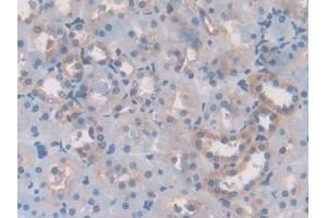 DAB staining on IHC-P; Samples: Rat Kidney Tissue (Laminin beta 3 antibody  (AA 503-738))