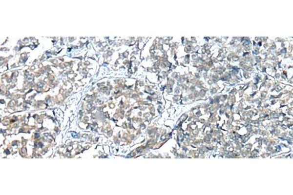 COMMD6 antibody