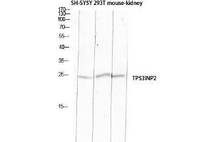 Western Blot (WB) analysis of SH-SY5Y 293T Mouse Kidney lysis using TP53INP2 antibody. (TP53INP2 antibody)
