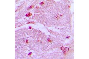 Immunohistochemical analysis of CSRP1 staining in human brain formalin fixed paraffin embedded tissue section. (CSRP1 antibody  (Center))