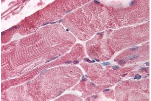 Human Skeletal Muscle (formalin-fixed, paraffin-embedded) stained with BMI1 antibody ABIN292553 at 2. (BMI1 antibody  (AA 252-264))