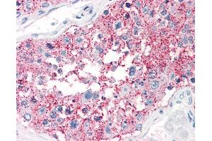 Anti-SRPX2 antibody IHC of human testis. (SRPX2 antibody  (C-Term))