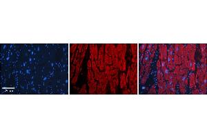 Rabbit Anti-OTUD7B Antibody    Formalin Fixed Paraffin Embedded Tissue: Human Adult heart  Observed Staining: Cytoplasmic Primary Antibody Concentration: 1:600 Secondary Antibody: Donkey anti-Rabbit-Cy2/3 Secondary Antibody Concentration: 1:200 Magnification: 20X Exposure Time: 0. (OTUD7B antibody  (Middle Region))