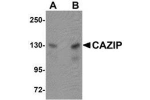 Western blot analysis of CAZIP in A20 cell lysate with AP30208PU-N CAZIP antibody at (A) 0. (CAZIP antibody  (C-Term))