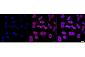 Immunocytochemical staining of HepG2 cells with AGR2 antibody (ABIN7797627), 1:1,000). (Recombinant AGR2 antibody)