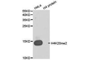 Western blot analysis of extracts of HeLa cell line and H4 protein expressed in E. (Histone 3 antibody  (2meLys20))