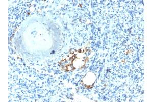Formalin-fixed, paraffin-embedded human Spleen stained with TRAcP Rabbit Recombinant Monoclonal Antibody (ACP5/2336R). (Recombinant ACP5 antibody)