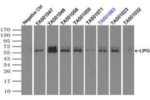 Image no. 1 for anti-Lipase, Endothelial (LIPG) antibody (ABIN1499169) (LIPG antibody)