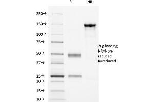 SDS-PAGE Analysis Purified CD16 Mouse Monoclonal Antibody (HuNK2). (FCGR3A antibody)