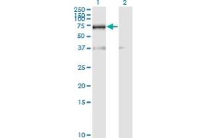 Western Blot analysis of RBM39 expression in transfected 293T cell line by RNPC2 monoclonal antibody (M01), clone 4G8. (RBM39 antibody  (AA 423-472))