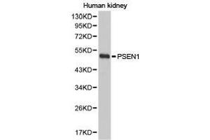 Western Blotting (WB) image for anti-Presenilin 1 (PSEN1) antibody (ABIN1874357) (Presenilin 1 antibody)