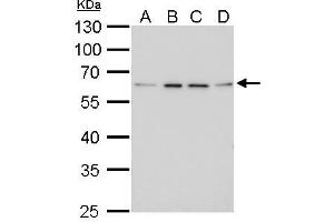 WB Image FGFR-5 antibody detects FGFR-5 protein by Western blot analysis. (FGFRL1 antibody)