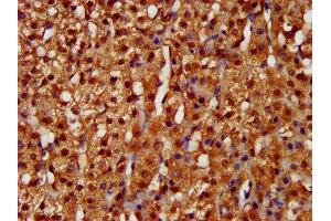 LARP6 antibody  (AA 294-453)