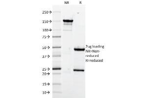 SDS-PAGE Analysis Purified CD106 Monoclonal Antibody (1. (VCAM1 antibody)