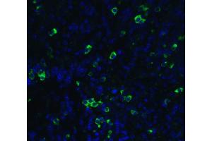 Immunofluorescent analysis of 4% paraformaldehyde-fixed human cervix cells labeling MANF with ABIN6990751 at 20 ug/mL, followed by goat anti-rabbit IgG secondary antibody at 1/500 dilution (green) and DAPI antibody (blue). (MANF antibody  (C-Term))