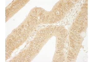 Immunohistochemistry (IHC) image for anti-Catenin (Cadherin-Associated Protein), delta 1 (CTNND1) (AA 75-125) antibody (ABIN7448502)