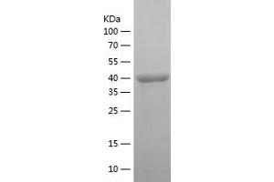 Western Blotting (WB) image for Malic Enzyme 1, NADP(+)-Dependent, Cytosolic (ME1) (AA 226-572) protein (His tag) (ABIN7282010) (ME1 Protein (AA 226-572) (His tag))