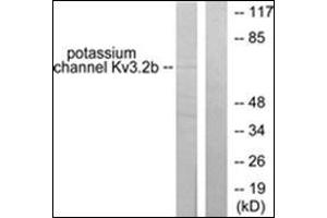 Western blot analysis of extracts from HepG2 cells, using KCNC2 antibody.