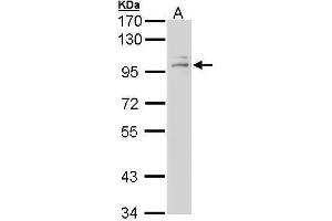 WB Image Sample (30 ug of whole cell lysate) A: A431 , 7. (Glucocorticoid Receptor antibody  (N-Term))