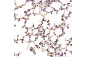 Immunohistochemistry of paraffin-embedded mouse lung using TSC22D3 Antibody. (TSC22D3 antibody  (AA 1-79))