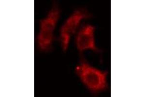 ABIN6274241 staining HepG2 cells by IF/ICC. (ACTN3 antibody  (N-Term))
