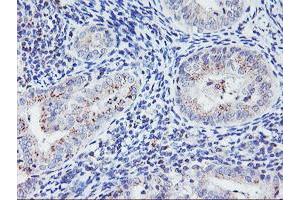 Immunohistochemistry (IHC) image for anti-Hes Family bHLH Transcription Factor 1 (HES1) antibody (ABIN1498636) (HES1 antibody)