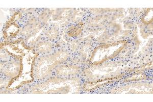 Detection of GITR in Human Kidney Tissue using Polyclonal Antibody to Glucocorticoid Induced Tumor Necrosis Factor Receptor (GITR) (Glucocorticoid Induced Tumor Necrosis Factor Receptor (AA 39-152) antibody)