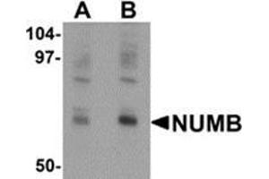 Western blot analysis of NUMB in mouse lung tissue lysate with NUMB antibody at (A) 0.