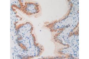 Figure. (PLA2R1 antibody  (AA 1418-1487))
