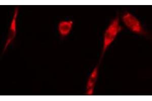 ABIN6266696 staining 293 cells by IF/ICC. (GAK antibody  (N-Term))