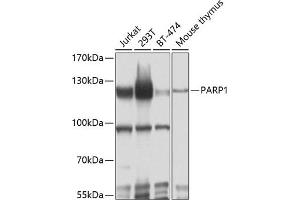 Western blot analysis of extracts of various cell lines, using P antibody (ABIN6134593, ABIN6145233, ABIN6145235 and ABIN6215036) at 1:1000 dilution. (PARP1 antibody  (AA 150-250))