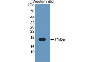 Detection of Recombinant CYP11A1, Bovine using Polyclonal Antibody to Cytochrome P450 11A1 (CYP11A1) (CYP11A1 antibody  (AA 391-515))