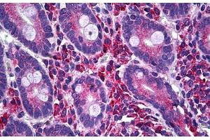 Human Small Intestine: Formalin-Fixed, Paraffin-Embedded (FFPE) (LIM Domain Kinase 1 antibody  (AA 548-648))