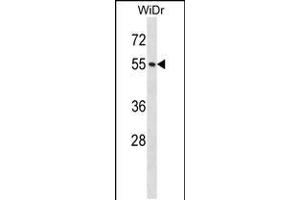Western blot analysis in WiDr cell line lysates (35ug/lane). (NUP50 antibody  (AA 224-252))