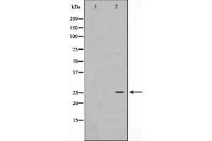 Western blot analysis on HeLa cell lysate using EFNA5 Antibody,The lane on the left is treated with the antigen-specific peptide. (Ephrin A5 antibody  (Internal Region))