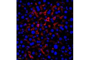 Immunofluorescence (Paraffin-embedded Sections) (IF (p)) image for anti-alpha-2-HS-Glycoprotein (AHSG) antibody (ABIN7073021)
