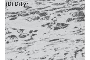 Immunohistochemistry image of dityrosine staining in paraffin section of human atherosclerotic lesion. (Dityrosine antibody)
