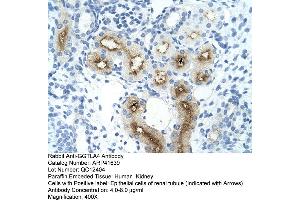 Rabbit Anti-GGTLA4 Antibody  Paraffin Embedded Tissue: Human Kidney Cellular Data: Epithelial cells of renal tubule Antibody Concentration: 4. (GGTLC1 antibody  (C-Term))