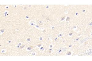 Detection of CASP12 in Human Cerebrum Tissue using Polyclonal Antibody to Caspase 12 (CASP12) (Caspase 12 antibody  (AA 101-337))