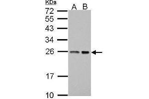 WB Image Sample (30 ug of whole cell lysate) A: A431 B: HeLa 12% SDS PAGE antibody diluted at 1:1000 (BAG2 antibody)