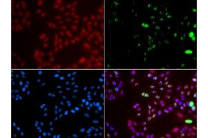 Immunofluorescence analysis of GFP-RNF168 transgenic U2OS cells using XPA antibody. (XPA antibody)