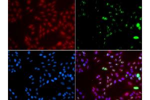 Immunofluorescence analysis of GFP-RNF168 transgenic U2OS cells using XPA antibody. (XPA antibody)