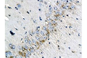 Formalin-fixed and paraffin embedded rat brain labeled with Anti-CD46/MCP (human) Polyoclonal Antibody, Unconjugated (ABIN687832) at 1:200 followed by conjugation to the secondary antibody and DAB staining (CD46 antibody  (AA 251-355))