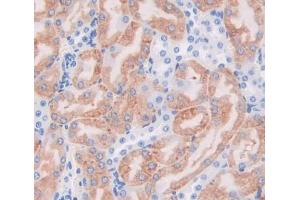 Immunohistochemistry (IHC) image for anti-Acetyl-CoA Acyltransferase 2 (ACAA2) (AA 90-397) antibody (ABIN5013060)