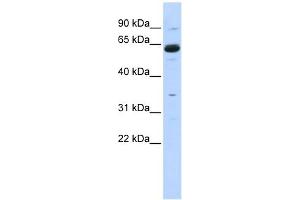 Copine I antibody used at 1 ug/ml to detect target protein. (CPNE1 antibody  (Middle Region))