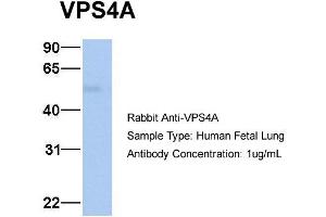 Host: Rabbit Target Name: VPS4A Sample Type: Human Fetal Lung Antibody Dilution: 1. (VPS4A antibody  (N-Term))